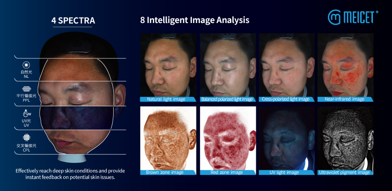 MEICET PRO-A Skin Analyzer,美測,肌膚檢測儀,醫思欣泰